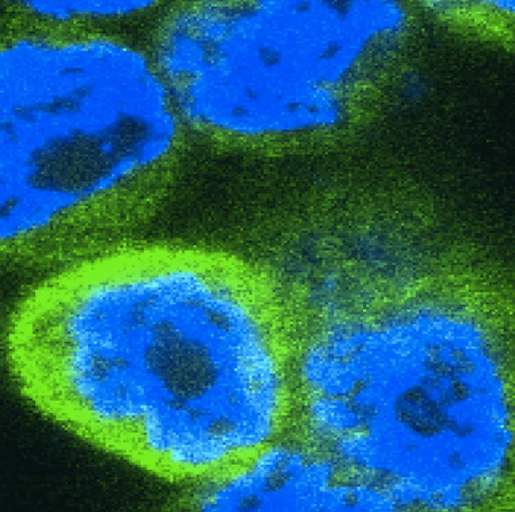 Inflammatory Cytokines